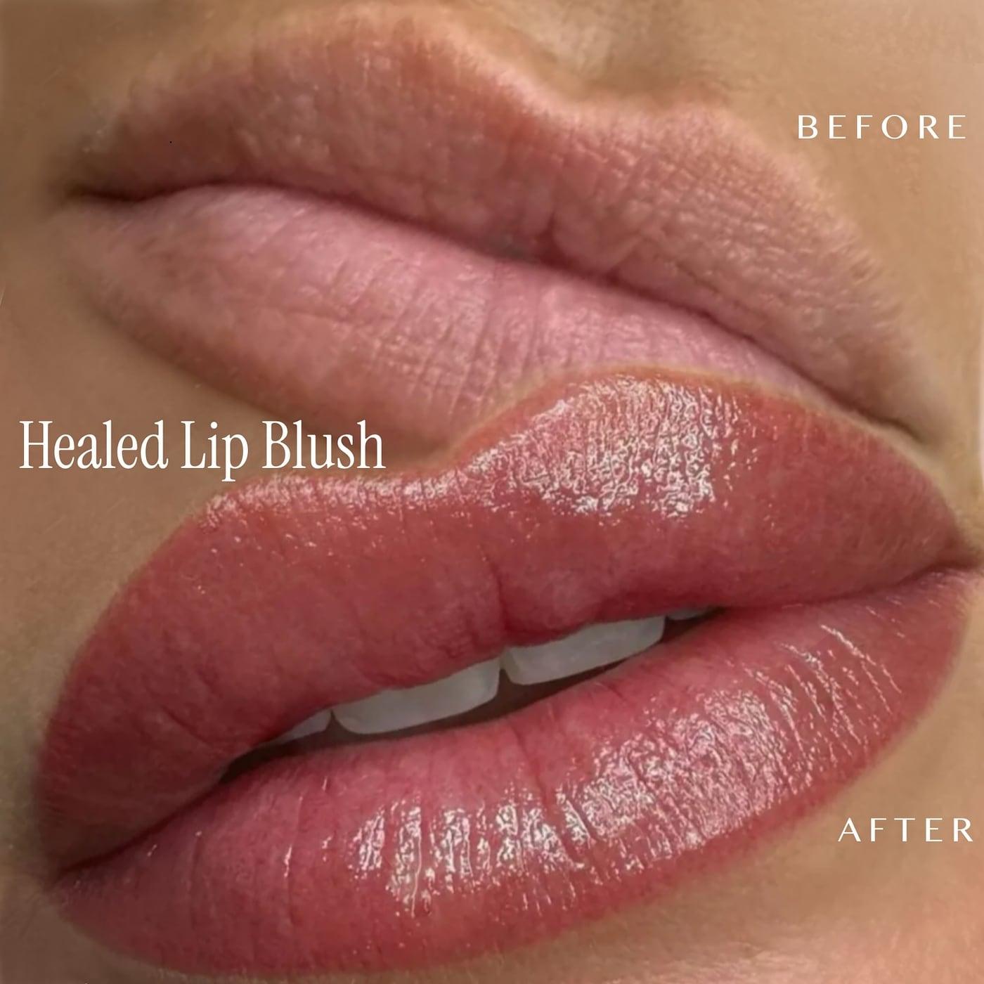 Lips before and after healed lip blush, from pale to an even rose color