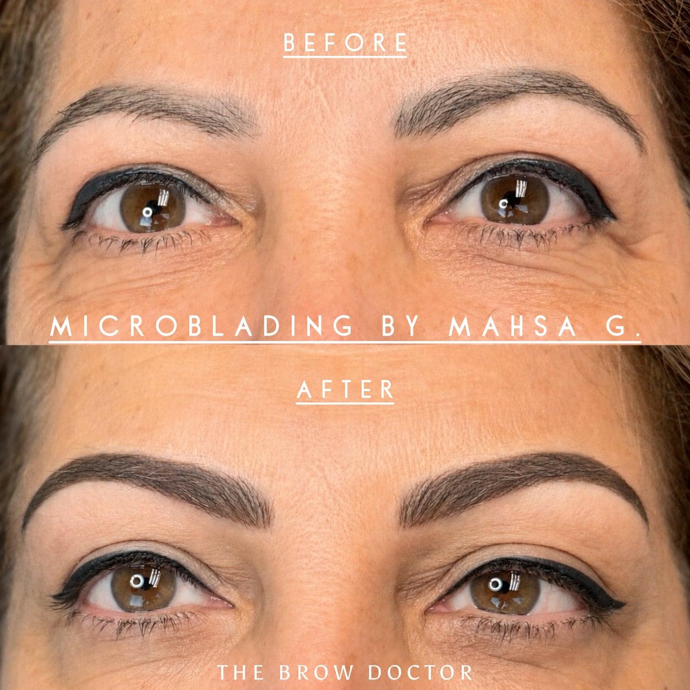 Before and after microblading: thin, uneven brows above and fuller arched brows below