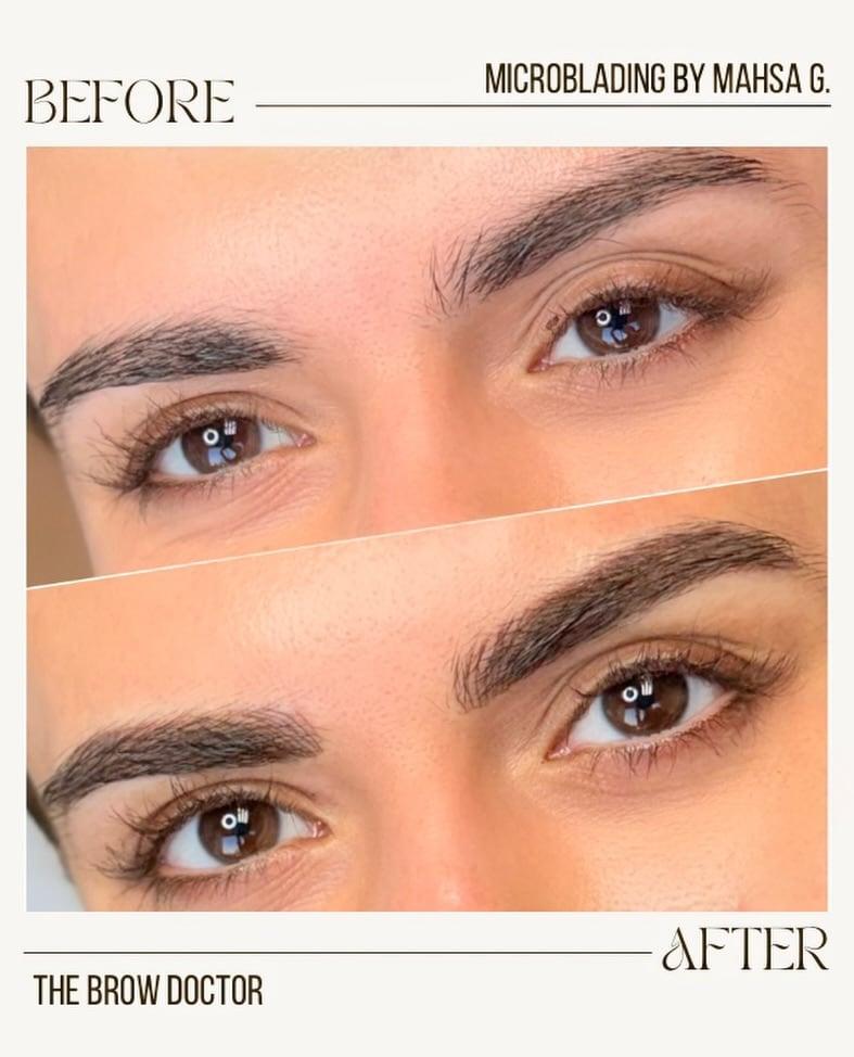 Before and after microblading on a young client: sparse brows above, fuller, defined brows below