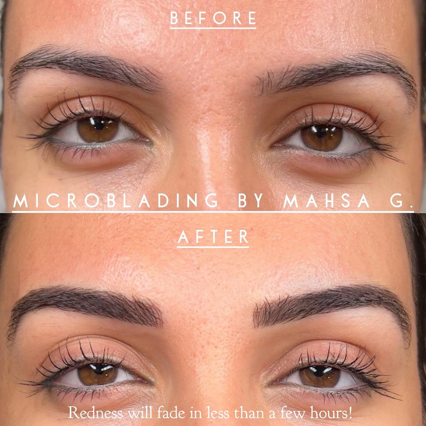 Before and after microblading the same day, with light redness around newly defined brows